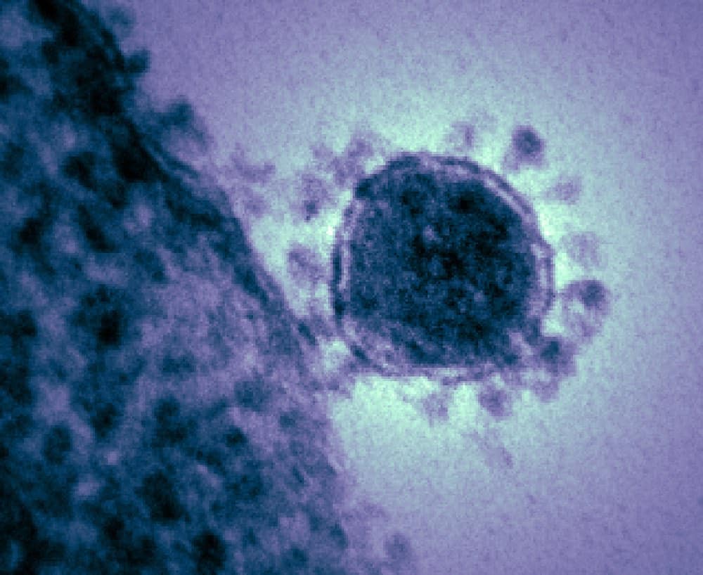 virus corona